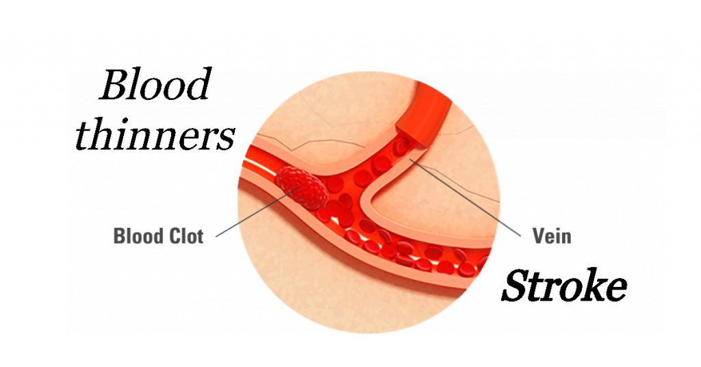 can too much blood thinner cause stroke Hematic Food